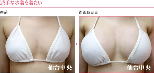 派手な水着を着たい 症例写真